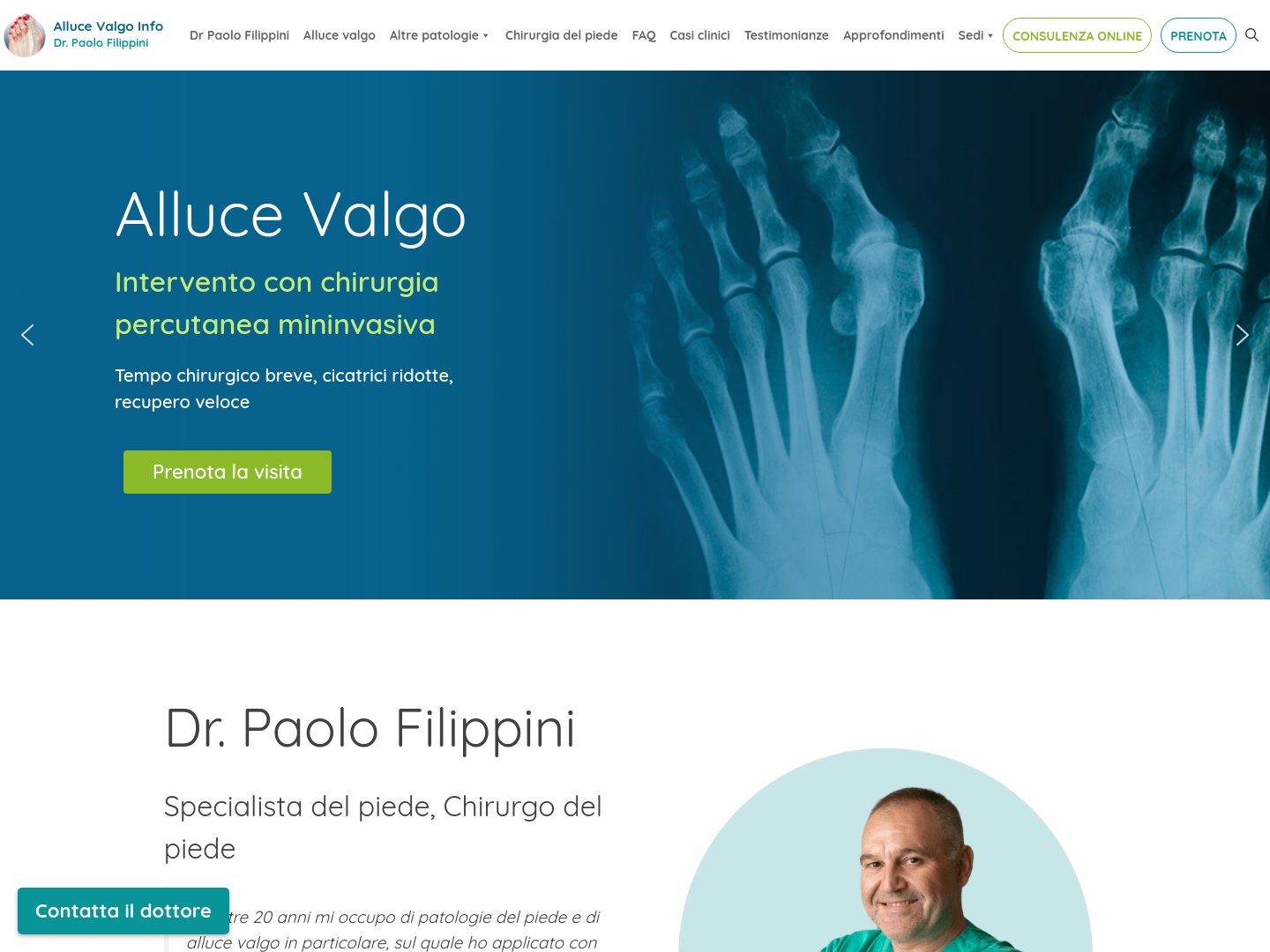 Sito AlluceValgoInfo.it — portale divulgativo