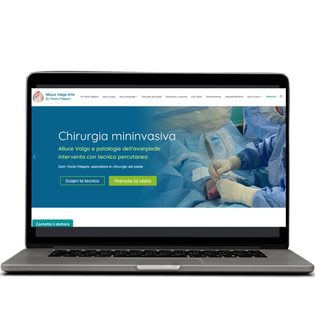 Sito realizzato da Digital Medica — AlluceValgo