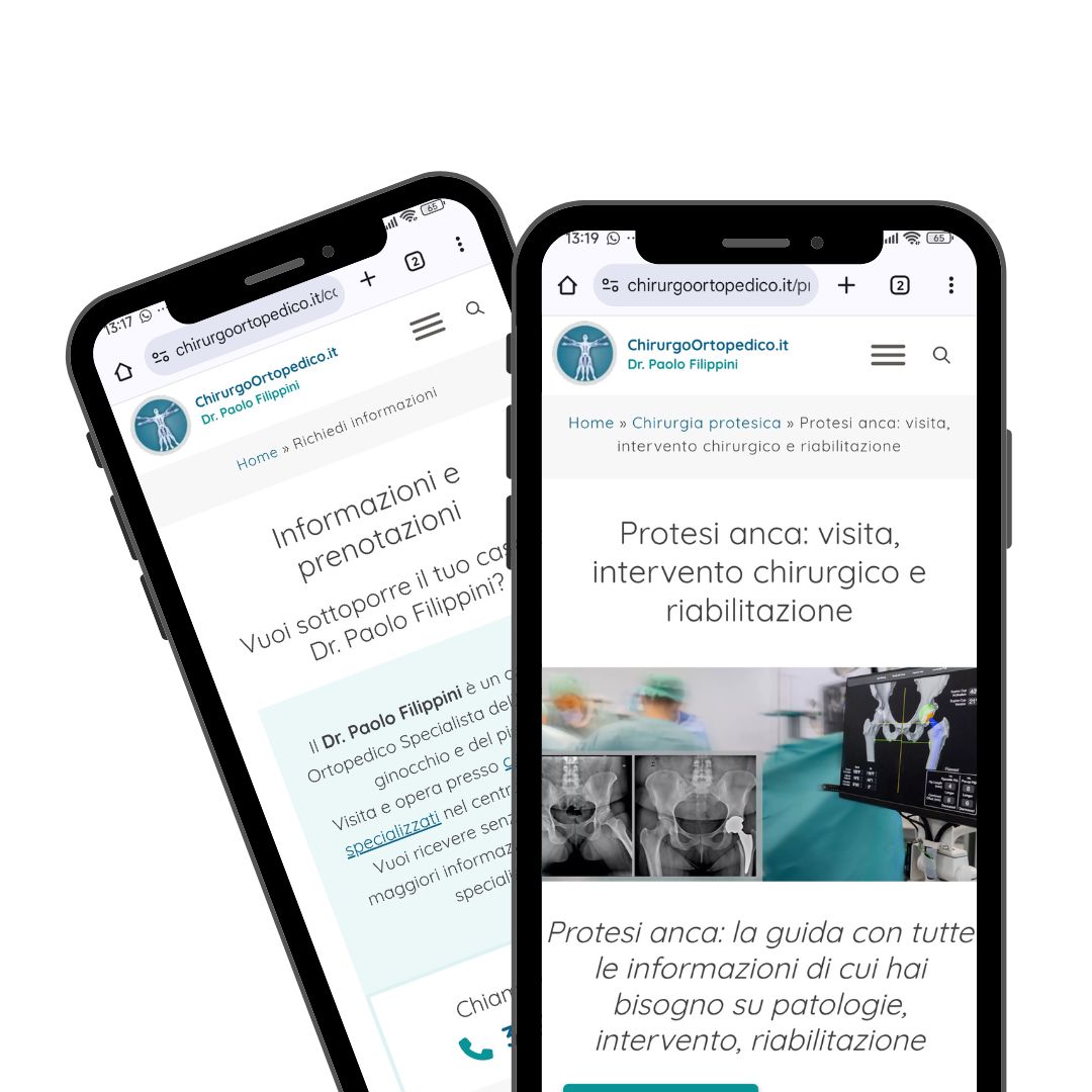Sito realizzato da Digital Medica — Dr. Paolo Filippini — chirurgo ortopedico