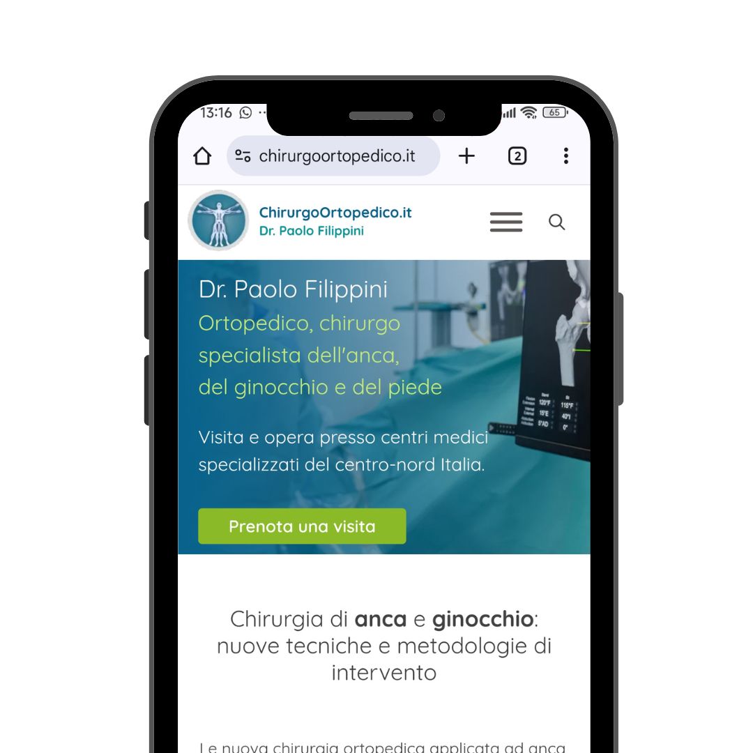 Sito realizzato da Digital Medica — Dr. Paolo Filippini — chirurgo ortopedico
